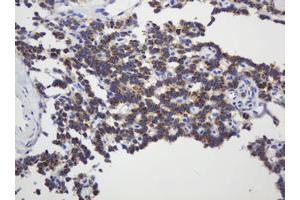 Image no. 4 for anti-Glyceraldehyde-3-Phosphate Dehydrogenase, Spermatogenic (GAPDHS) antibody (ABIN1498375) (GAPDHS anticorps)