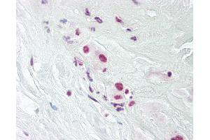 Anti-DPPA4 antibody IHC of human placenta. (DPPA4 anticorps  (AA 1-50))