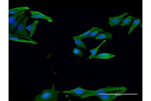 Immunofluorescence of monoclonal antibody to EN2 on HeLa cell.