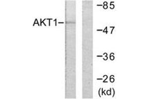 Western blot analysis of extracts from HeLa cells, treated with Etoposide 25uM 24h, using Akt (Ab-246) Antibody. (AKT1 anticorps  (AA 212-261))