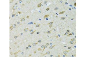 Immunohistochemistry of paraffin-embedded Rat brain using DCTN2 Polyclonal Antibody at dilution of 1:100 (40x lens).