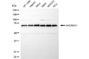 Western blotting analysis using KHDRBS1 antibody (ABIN7799193).