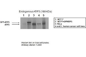 MTUS1 antibody - middle region  validated by WB using MCF-7, HeLa, and human cancer cell lines at 1:2000.