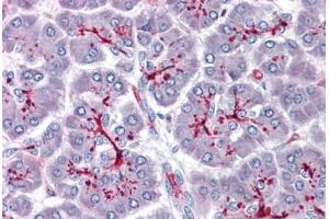 anti-SLAIN Motif Family, Member 1 (SLAIN1) (C-Term) antibody