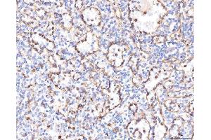 IHC analysis of KCNQ1 using anti-KCNQ1 antibody (ABIN4886647).