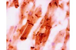 Immunohistochemistry on paraffin section of human heart (CTNNA3 anticorps)