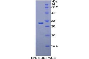 SDS-PAGE analysis of Mouse OCT Protein. (OTC Protéine)
