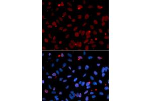 Immunofluorescence analysis of U2OS cell using SFRS1 antibody. (SRSF1 anticorps  (pSer1))