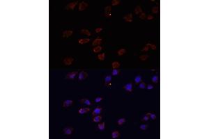 Immunofluorescence analysis of HeLa cells using  antibody (ABIN3021237, ABIN3021238, ABIN3021239 and ABIN6214079) at dilution of 1:100.