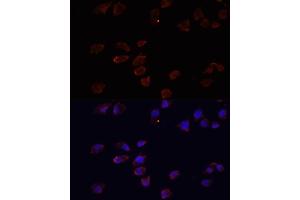Immunofluorescence analysis of HeLa cells using  antibody (ABIN3021237, ABIN3021238, ABIN3021239 and ABIN6214079) at dilution of 1:100. (ARF6 anticorps  (AA 1-175))