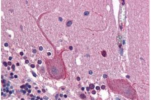 anti-Adaptor-Related Protein Complex 1, gamma 1 Subunit (AP1G1) (AA 574-623) antibody