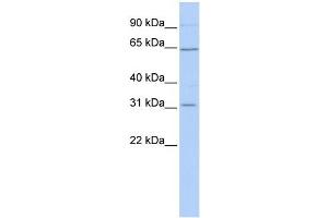 SLC27A2 antibody used at 1 ug/ml to detect target protein. (SLC27A2 anticorps)