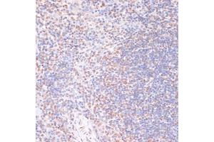 Immunohistochemistry of paraffin-embedded mouse spleen using Phospho-RPS6K-S376 antibody (ABIN7270039) at dilution of 1:100 (40x lens).
