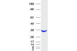 Validation with Western Blot