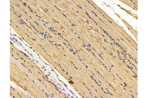 ABIN7095943 and ABIN7100005 at 1/100 staining rat muscle tissue by IHC-P. (EPM2AIP1 anticorps)