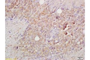 Formalin-fixed and paraffin embedded mouse lymphoma labeled with Rabbit Anti BCMA/CD269 Polyclonal Antibody, Unconjugated (ABIN705041) at 1:200 followed by conjugation to the secondary antibody and DAB staining
