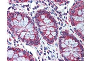PGLS antibody was used for immunohistochemistry at a concentration of 4-8 ug/ml. (PGLS anticorps  (Middle Region))