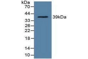 Detection of Recombinant LDHC, Rat using Polyclonal Antibody to Lactate Dehydrogenase C (LDHC)