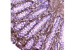 IHC analysis of Annexin VI using anti-Annexin VI antibody .