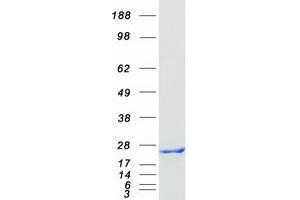 Validation with Western Blot