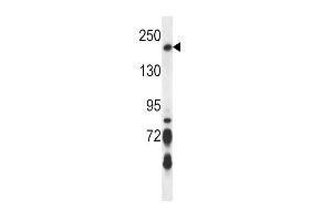 Western blot analysis in Jurkat cell line lysates (35ug/lane). (BRIP1 anticorps  (N-Term))