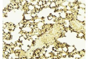 ABIN6267494 at 1/100 staining Mouse lung tissue by IHC-P.