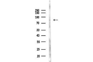 Western blot analysis of lysates from EC304 cells(heat-shock,45 min treatment), using Phospho-B Raf (Thr599) Antibody at 1/1000 dilution.
