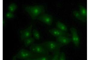 Detection of VAPB in Human Hela Cell using Polyclonal Antibody to Vesicle Associated Membrane Protein Associated Protein B (VAPB)