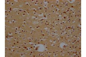 IHC image of ABIN7127436 diluted at 1:100 and staining in paraffin-embedded human brain tissue performed on a Leica BondTM system. (Recombinant XPO1 anticorps)