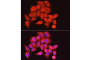 Immunofluorescence analysis of HeLa cells using PPP1R12A Rabbit pAb (ABIN6128260, ABIN6146059, ABIN6146061 and ABIN6213896) at dilution of 1:100 (40x lens). (PPP1R12A anticorps  (AA 1-200))