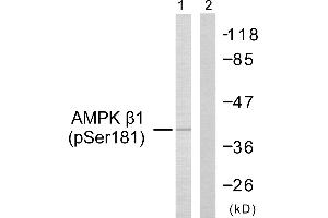 Western blot analysis of extracts from Jurkat cells, using AMPK β1 (Phospho-Ser181) Antibody (#A0410). (PRKAB1 anticorps  (pSer181))
