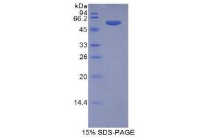 SDS-PAGE (SDS) image for Prolyl 4-Hydroxylase, beta Polypeptide (P4HB) (AA 216-465) protein (His tag,GST tag) (ABIN1879398)