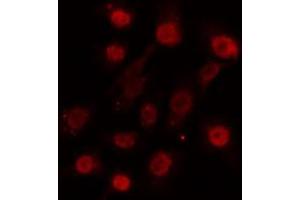 ABIN6274124 staining HuvEc cells by IF/ICC. (SUPT3H/SPT3 anticorps  (Internal Region))