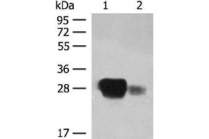 Western blot analysis of Raji cell and Human spleen tissue lysates using HLA-DPB1 Polyclonal Antibody at dilution of 1:350 (HLA-DPB1 anticorps)