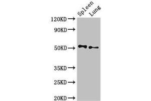 Western Blot Positive WB detected in: Rat spleen tissue, Rat lung tissue All lanes: PSEN2 antibody at 3 μg/mL Secondary Goat polyclonal to rabbit IgG at 1/50000 dilution Predicted band size: 51, 47 kDa Observed band size: 51 kDa (Presenilin 2 anticorps  (AA 7-77))