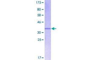 Image no. 1 for Chemokine (C-X-C Motif) Ligand 13 (CXCL13) (AA 1-109) protein (GST tag) (ABIN1350816)