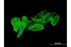 Immunofluorescence of monoclonal antibody to PSCD1 on HeLa cell.
