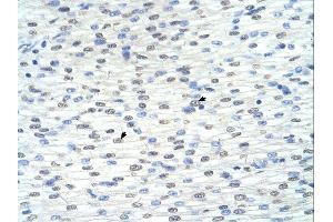 Immunohistochemistry (IHC) image for anti-Ring Finger Protein 8 (RNF8) (C-Term) antibody (ABIN2778597)