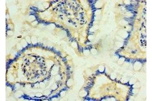 Immunohistochemistry of paraffin-embedded human small intestine tissue using ABIN7163815 at dilution of 1:100 (PKD2L1 anticorps  (AA 561-805))