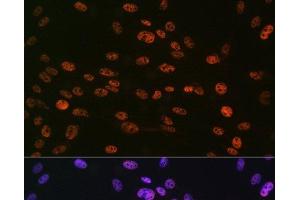 Immunofluorescence analysis of C6 cells using Phospho-Histone H3(S10) Polyclonal Antibody at dilution of 1:100 (40x lens). (Histone 3 anticorps  (pSer10))
