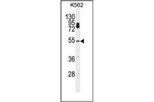 Western blot analysis of CPSF7 Antibody (C-term) Cat. (CPSF7 anticorps  (C-Term))