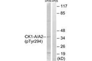 Western blot analysis of extracts from HT29 cells treated with heat shock, using CK-1 alpha (Phospho-Tyr294) Antibody. (CSNK1A1 anticorps  (pTyr294))