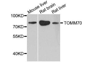 Western blot analysis of extracts of various cell lines, using TOMM70 antibody.