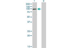 Western Blot analysis of ATP2A1 expression in transfected 293T cell line by ATP2A1 monoclonal antibody (M01), clone 1B11.