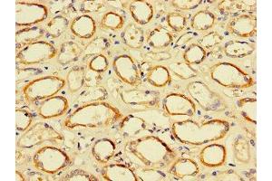 anti-Transcription Factor Dp-2 (E2F Dimerization Partner 2) (TFDP2) (AA 344-386) antibody