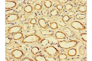 Immunohistochemistry of paraffin-embedded human kidney tissue using ABIN7172505 at dilution of 1:100 (DP2 anticorps  (AA 344-386))