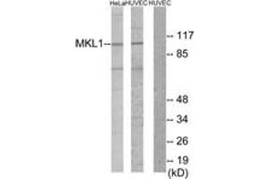 Western blot analysis of extracts from HuvEc/HeLa cells, using MKL1 Antibody. (MKL1 anticorps  (AA 10-59))