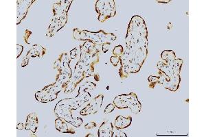 IHC analysis of LSM8 using anti-LSM8 antibody (ABIN7599578). (NAA38 anticorps  (AA 1-96))