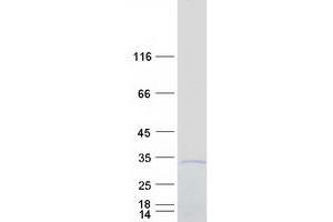 Validation with Western Blot