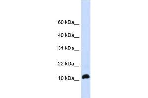 WB Suggested Anti-NHLH1 Antibody Titration: 0. (NHLH1 anticorps  (Middle Region))